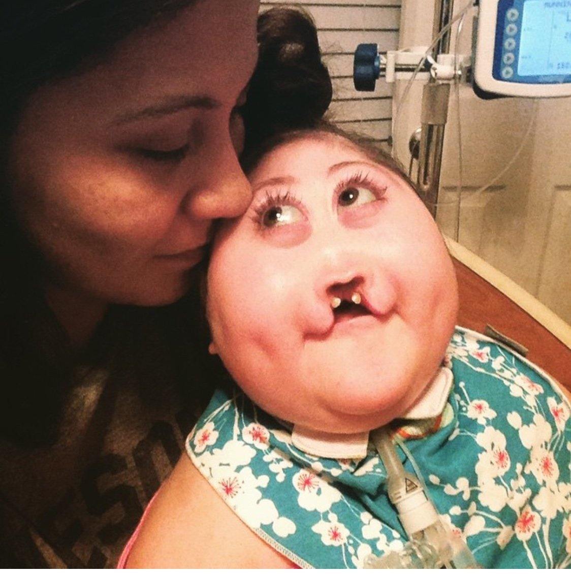 Parenting a Rare Child - EazyHold